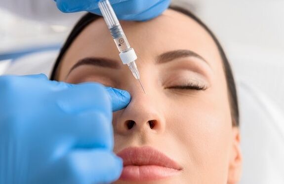 Method of non-jurse rhinoplasty