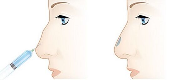 The procedure allows you to adjust different problems