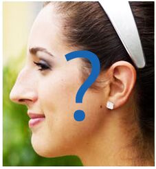 Deformation of the nose after rhinoplasty
